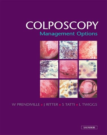 Colposcopy : management options