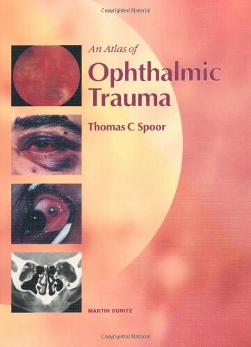 An atlas of ophthalmic trauma