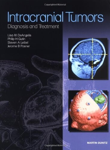 Intracranial tumors : diagnosis and treatment