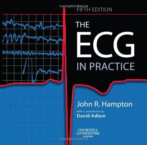 The ECG In Practice