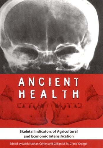 Ancient health : skeletal indicators of agricultural and economic intensification