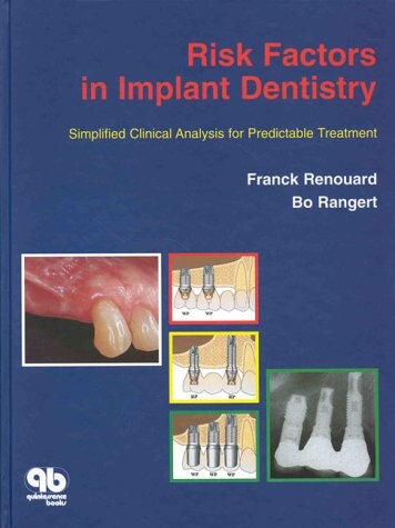 Risk factors in implant dentistry : simplified clinical analysis for predictable treatment