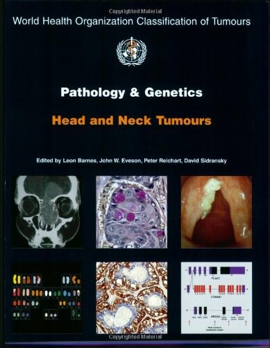 Pathology and Genetics of Head and Neck Tumours (IARC WHO Classification of Tumours)