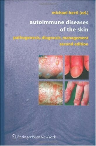 Autoimmune diseases of the skin :pathogenesis, diagnosis, management