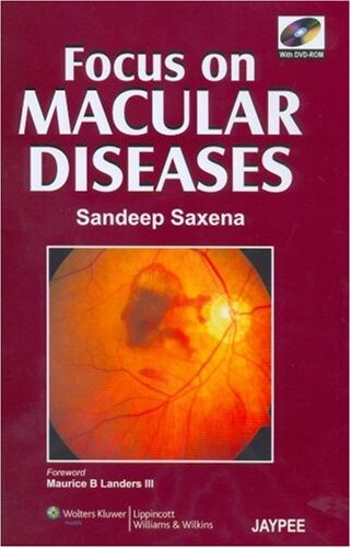 Focus on macular diseases