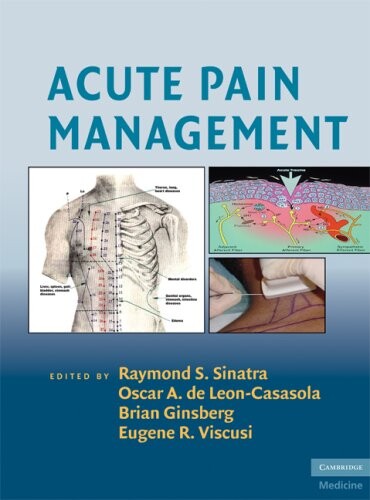 Acute Pain Management (Cambridge Medicine)