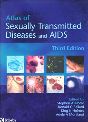 Atlas of sexually transmitted diseases and AIDS