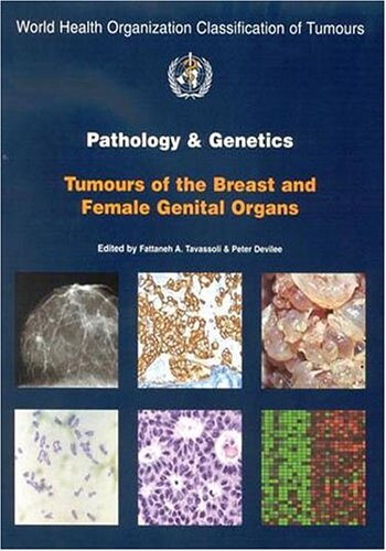 Pathology and genetics of tumours of the breast and female genital organs