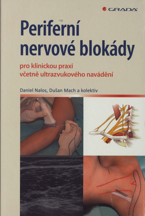 Periferní nervové blokády: pro klinickou praxi včetně ultrazvukového navádění