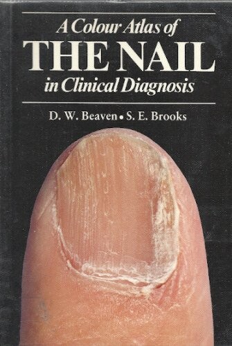 Color Atlas of Nails (Wolfe Medical Atlases)