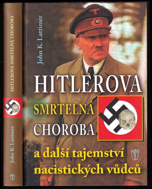 Hitlerova smrtelná choroba a další tajemství nacistických vůdců
