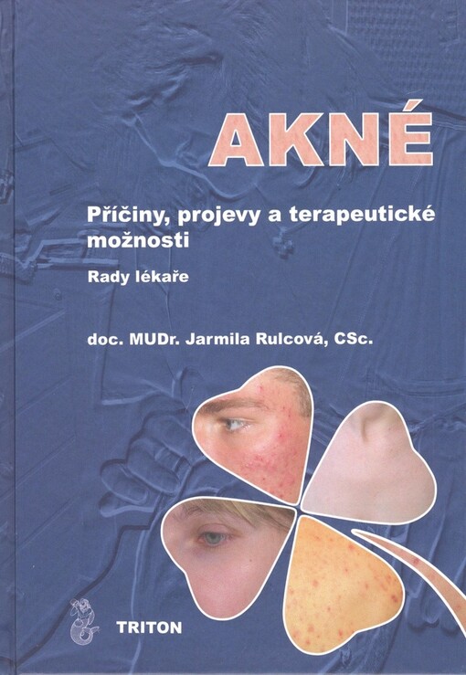 Akné: příčiny, projevy a terapeutické možnosti : rady lékaře
