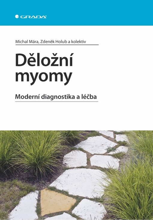 Děložní myomy: moderní diagnostika a léčba