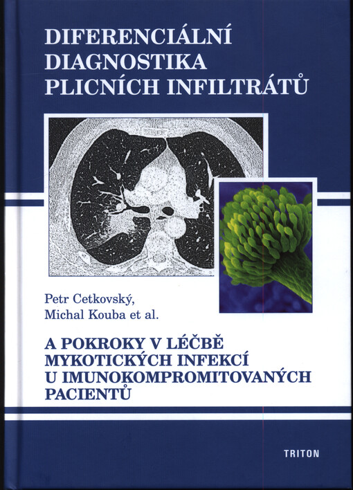 Diferenciální diagnostika plicních infiltrátů a pokroky v léčbě mykotických infekcí u imunokompromitovaných pacientů