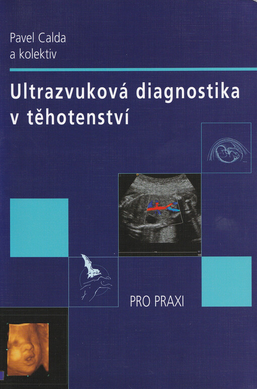 Ultrazvuková diagnostika v těhotenství