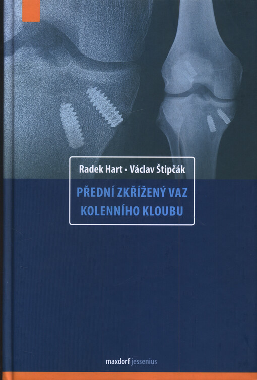 Přední zkřížený vaz kolenního kloubu