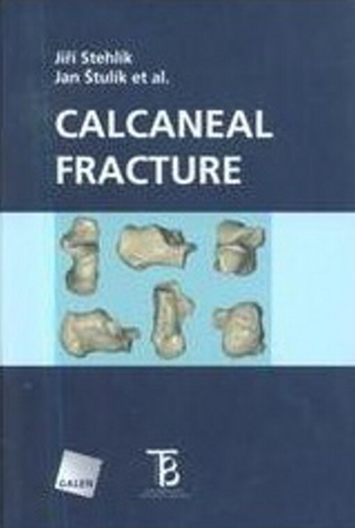 Calcaneal fracture