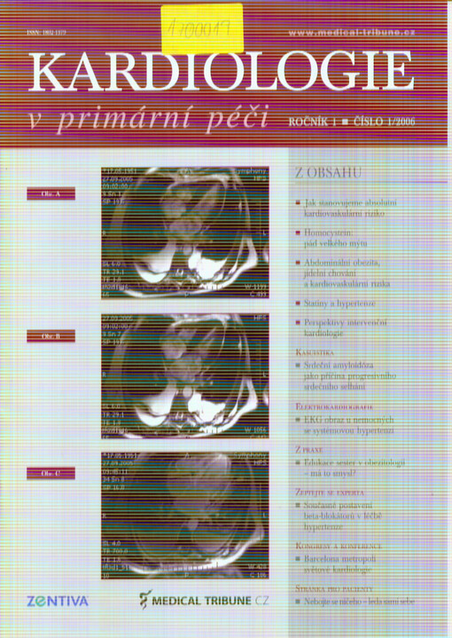 Kardiologie v primární péči