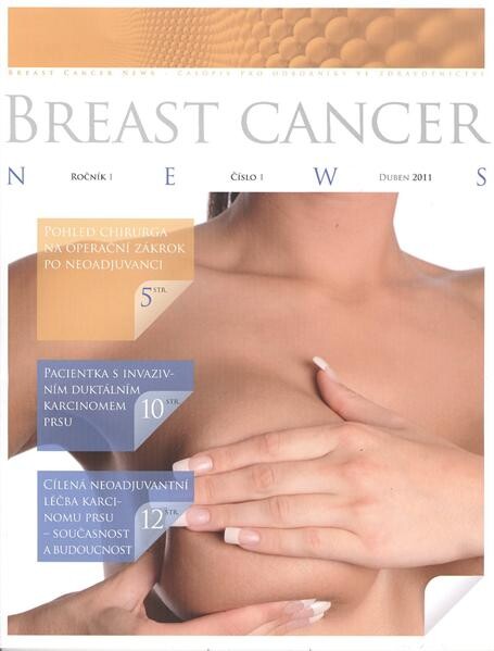 Breast cancer news 