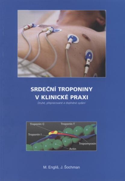 Srdeční troponiny v klinické praxi