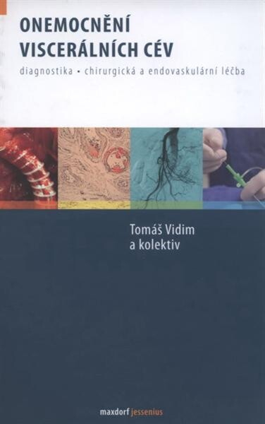 Onemocnění viscerálních cév