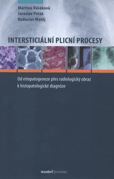 Intersticiální plicní procesy : od etiopatogeneze přes radiologický obraz k histopatologické diagnóze