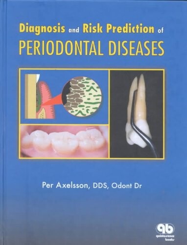 Diagnosis and risk prediction of periodontal diseases