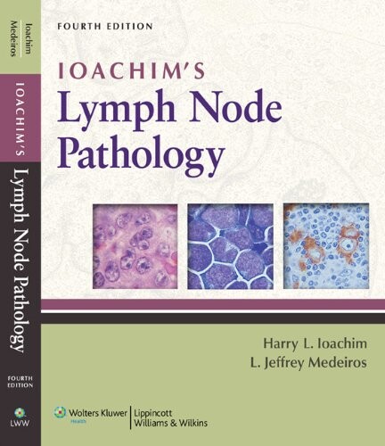 Ioachim's lymph node pathology
