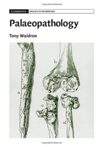 Palaeopathology