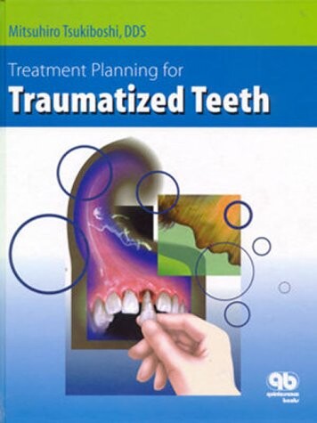 Treatment planning for traumatized teeth