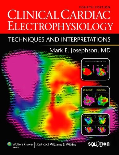 Clinical Cardiac Electrophysiology: Techniques and Interpretations (Solution (Lippincott Williams & Wilkins))