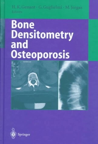 Bone densitometry and osteoporosis