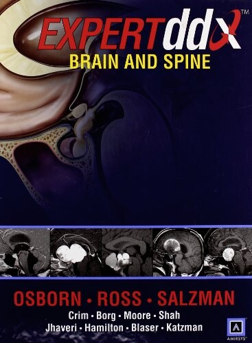 Expertddx.Brain and spine