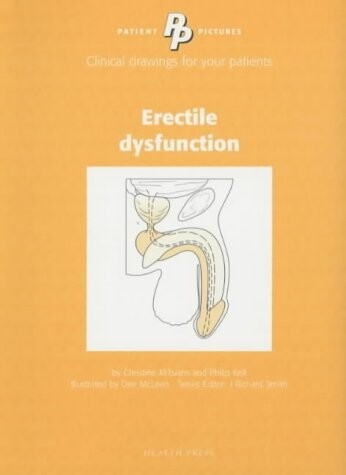 Patient Pictures Erectile Dysfunction