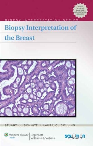Biopsy Interpretation of the Breast (Biopsy Interpretation Series)