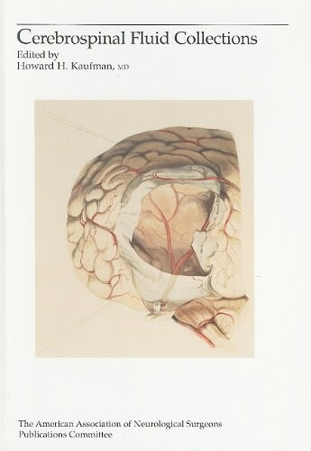 Cerebrospinal Fluid Collections