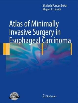 Atlas of minimally invasive surgery in esophageal carcinoma