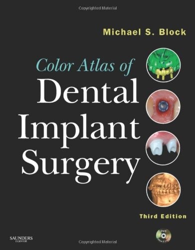 Color Atlas of Dental Implant Surgery (Book & DVD)