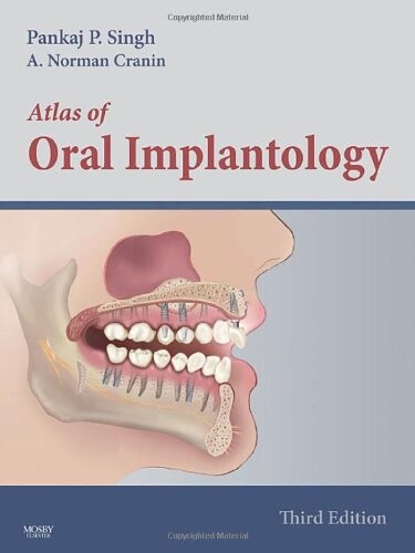 Atlas of Oral Implantology