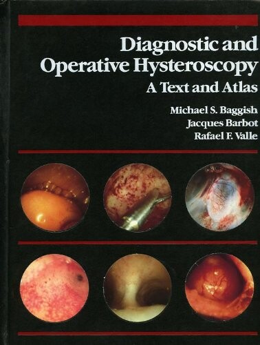 Diagnostic and operative hysteroscopy : a text and atlas