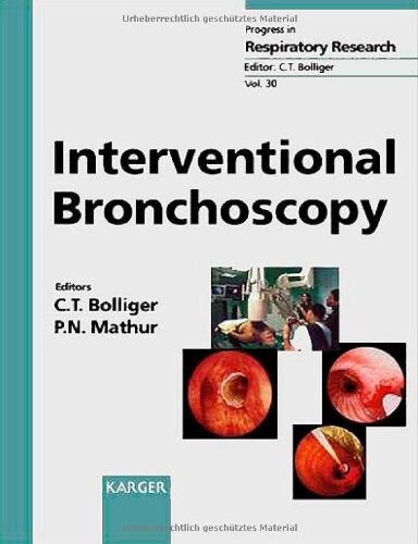 Interventional Bronchoscopy (Progress in Respiratory Research)