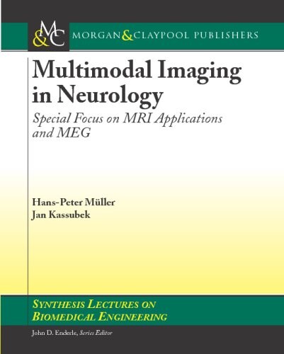 Multmodal Imaging in Neurology: Special Focus on MRI Applications and MEG (Synthesis Lectures on Biomedical Engineering)