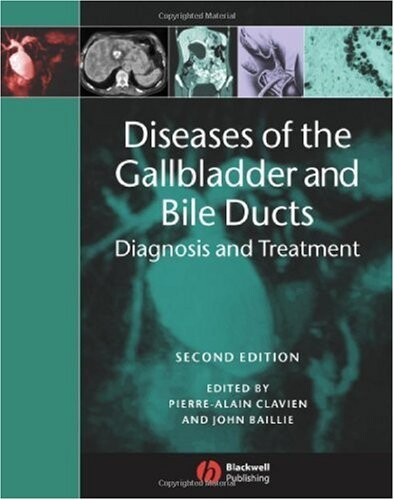 Diseases of the Gallbladder and Bile Ducts: Diagnosis and Treatment