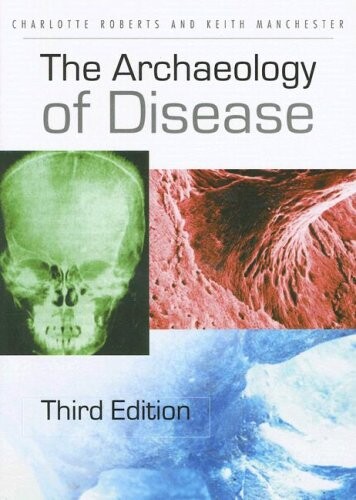 The archaeology of disease