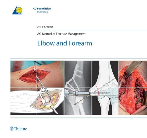 AO manual of fracture management : elbow and forearm