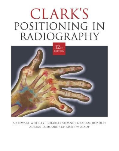 Clark's positioning in radiography