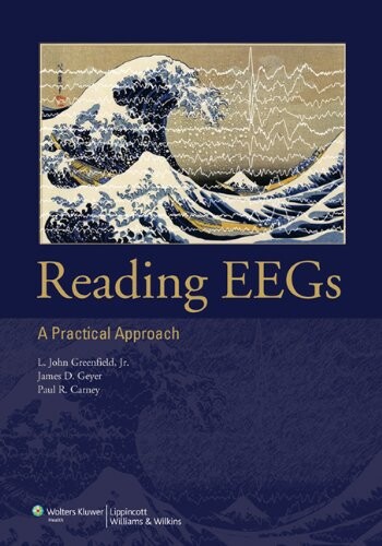Reading EEGs: A Practical Approach