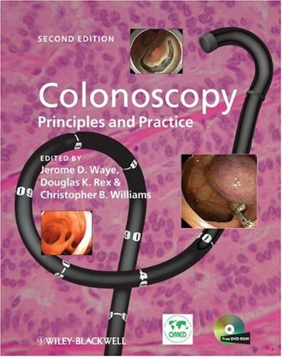 Colonoscopy : principles and practice