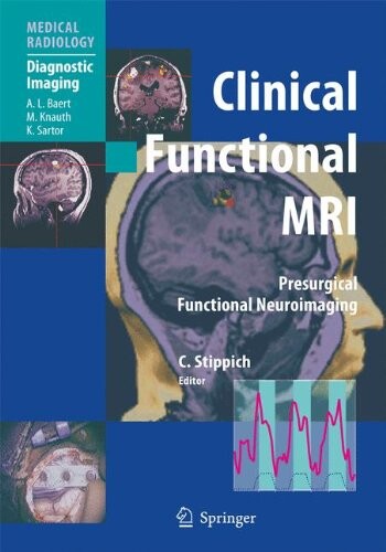 Clinical functional MRI : presurgical functional neuroimaging