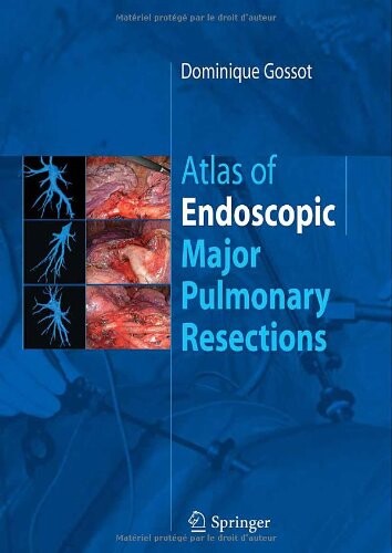 Atlas of endoscopic major pulmonary resections